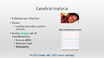 Cerebral malaria