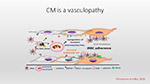  CM is a vaculopathy