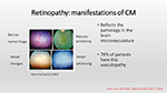 Retinopathy